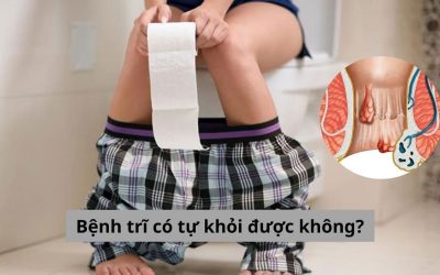 [Giải đáp] Thực hư vấn đề bệnh trĩ có tự khỏi được không?