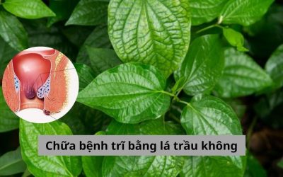 [Chia sẻ] 4 cách chữa bệnh trĩ bằng lá trầu không và những lưu ý cần biết