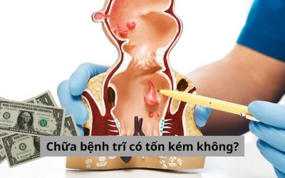 Chữa bệnh trĩ có tốn kém không? Những loại phí cần chi trả
