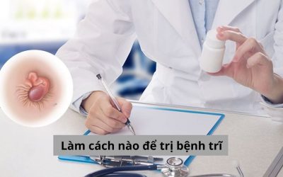 Bác sĩ chia sẻ phương pháp làm cách nào để trị bệnh trĩ hiệu quả