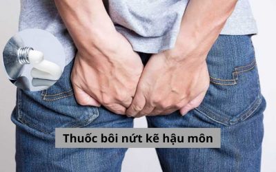 Thuốc bôi nứt kẽ hậu môn loại nào hiệu quả nhất?