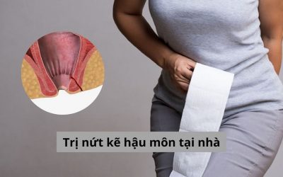 Bỏ túi 5 mẹo trị nứt kẽ hậu môn tại nhà hiệu quả có thể tham khảo
