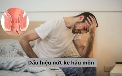 Các dấu hiệu nứt kẽ hậu môn cần được điều trị ngay lập tức