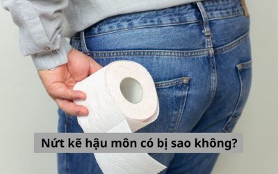 Bệnh nứt kẽ hậu môn có bị sao không – lời giải đáp từ chuyên gia?