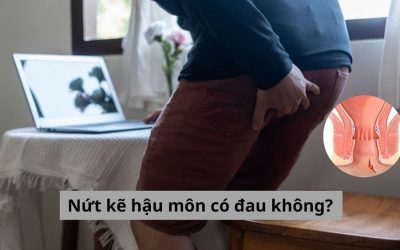 Nứt kẽ hậu môn có đau không, cách giảm đau hiệu quả