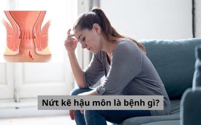 Nứt kẽ hậu môn là bệnh gì? Có nguy hiểm không và làm sao để chữa?