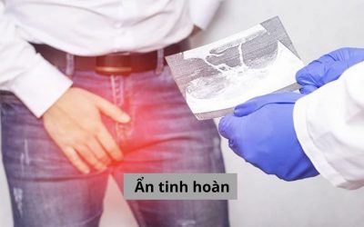 Tìm hiểu về bệnh ẩn tinh hoàn có gây vô sinh không?
