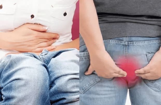 Biểu hiện lòi dom như thế nào?