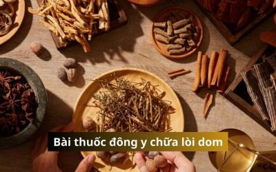 Các bài thuốc đông y chữa lòi dom an toàn và hiệu quả