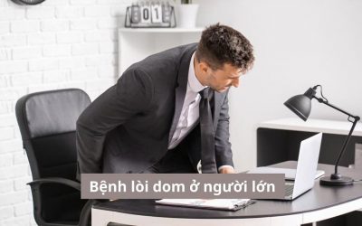 Tổng hợp toàn bộ thông tin từ a-z về bệnh lòi dom ở người lớn