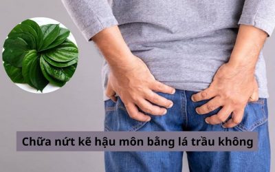 Chuyên gia tư vấn cách chữa nứt kẽ hậu môn bằng lá trầu không tại nhà