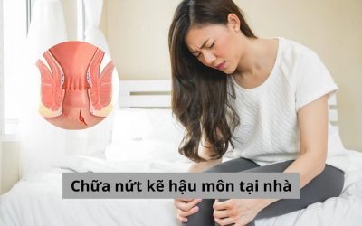 Top 6 phương pháp chữa nứt kẽ hậu môn tại nhà được thực hiện nhiều