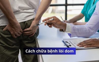Cách chữa bệnh lòi dom hiệu quả là gì? Nên chữa ở đâu?