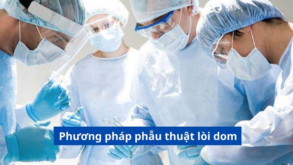 Phương pháp phẫu thuật lòi dom: Thực hiện như nào mang lại hiệu quả?