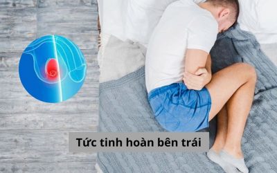 [Góc hỗ trợ] Tức tinh hoàn bên trái liệu có phải biểu hiện bất thường?