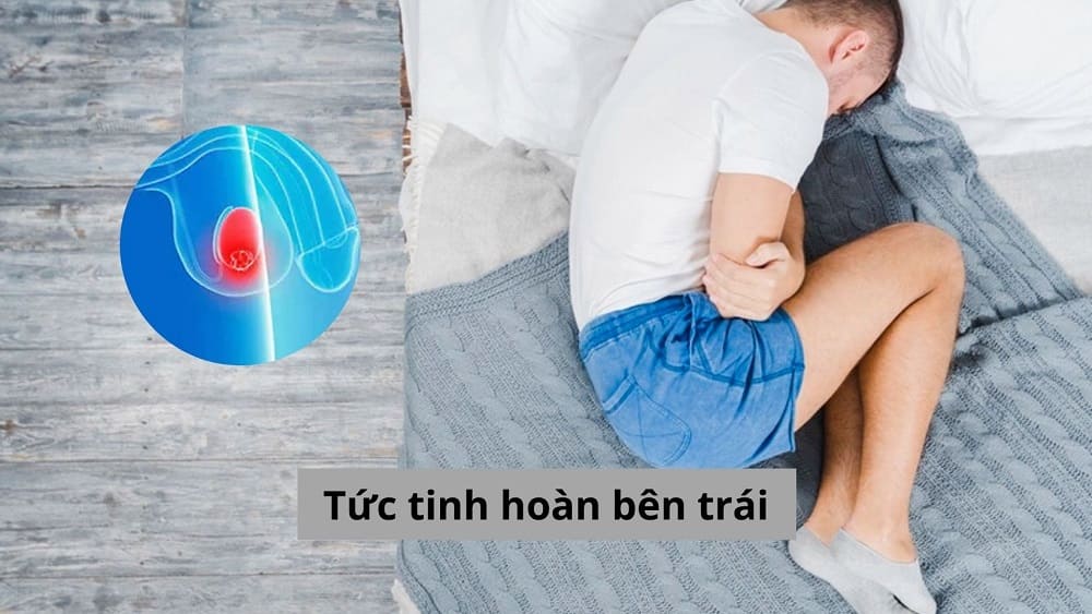 [Góc hỗ trợ] Tức tinh hoàn bên trái liệu có phải biểu hiện bất thường?