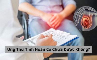 Ung Thư Tinh Hoàn Có Chữa Được Không? Câu Trả Lời Cho Bạn