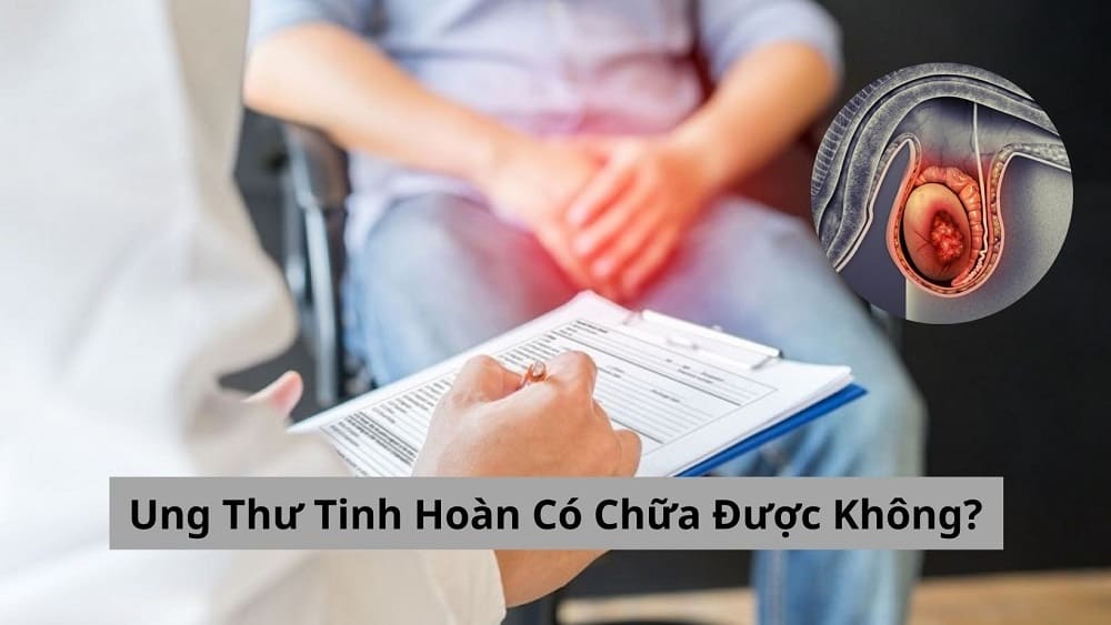 Ung Thư Tinh Hoàn Có Chữa Được Không? Câu Trả Lời Cho Bạn
