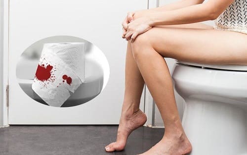 Thiếu máu trầm trọng