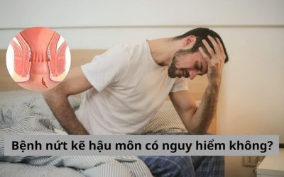 Bệnh nứt kẽ hậu môn có nguy hiểm không? – 5 biến chứng dễ gặp