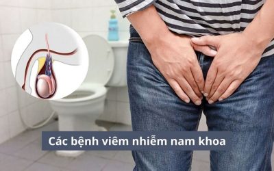 Bác sĩ tiết lộ các bệnh viêm nhiễm nam khoa phổ biến và cách điều trị