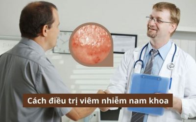 Đông y hay Tây y? Đâu là cách điều trị viêm nhiễm nam khoa hiệu quả? 