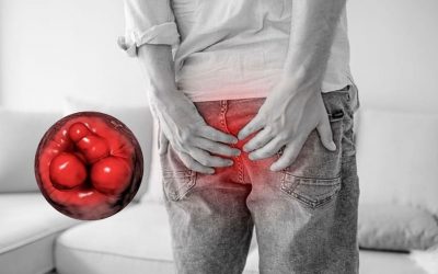 Cách chữa lòi dom ở hậu môn hiệu quả, hạn chế tái phát