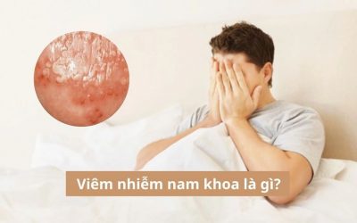 Viêm nhiễm nam khoa là gì? Bật mí 05 bệnh viêm nhiễm nam khoa
