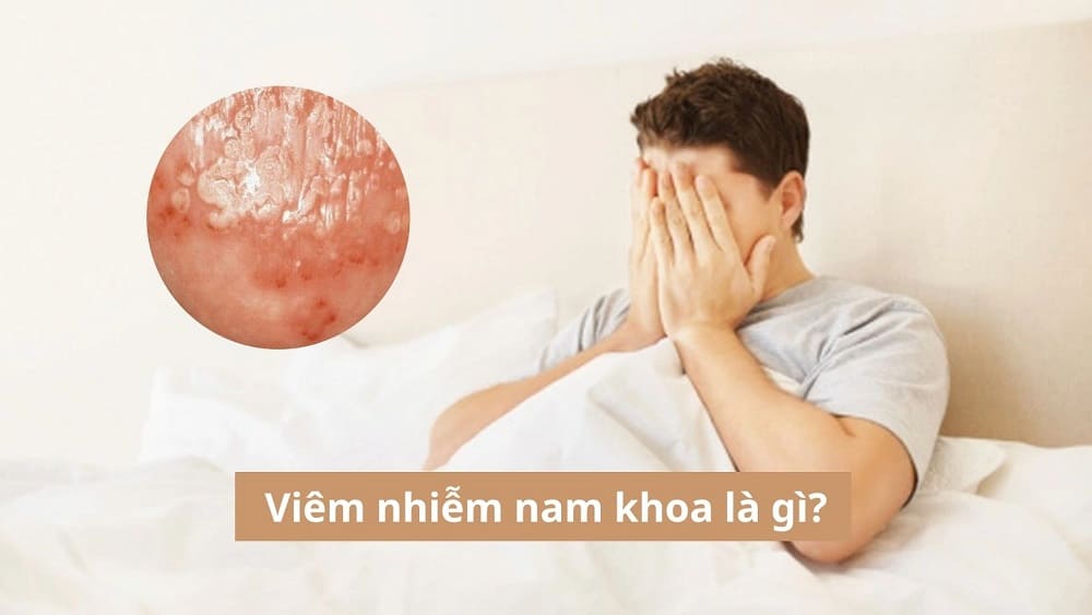 Viêm nhiễm nam khoa là gì? Bật mí 05 bệnh viêm nhiễm nam khoa