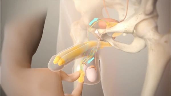 Nguyên nhân gây liệt dương là gì? - Do rối loạn thần kinh