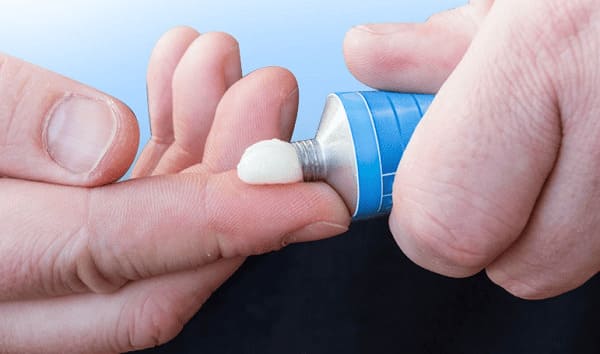 Mắc nứt kẽ hậu môn dùng thuốc gì?