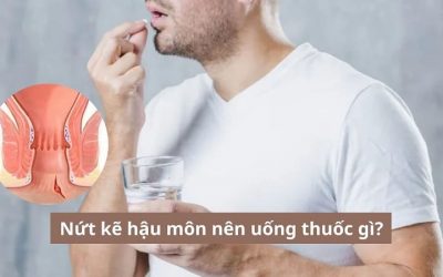 Nứt kẽ hậu môn nên uống thuốc gì? Gợi ý giúp sớm khỏi bệnh