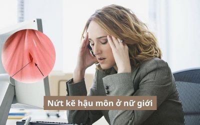 Vài điều cần biết về bệnh nứt kẽ hậu môn ở nữ giới