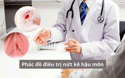 [Góc thông tin] Phác đồ điều trị nứt kẽ hậu môn hiệu quả mới nhất