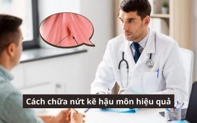 Cập nhật nhanh: Cách chữa nứt kẽ hậu môn hiệu quả mới nhất