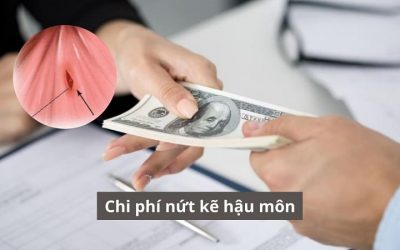Hiểu đúng chi phí nứt kẽ hậu môn để điều trị an toàn và tiết kiệm