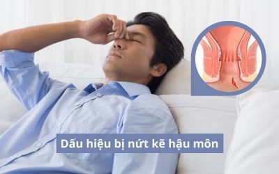 Dấu hiệu bị nứt kẽ hậu môn – Đừng chủ quan tránh biến chứng nặng nề