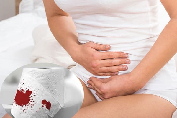 Khi nào cần đi khám vì đi ngoài ra máu nứt kẽ hậu môn?