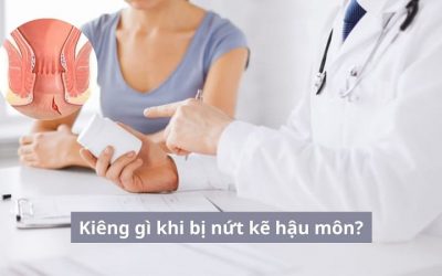 Kiêng gì khi bị nứt kẽ hậu môn? 6 điều cần tránh để vết rách ngày càng “lớn”