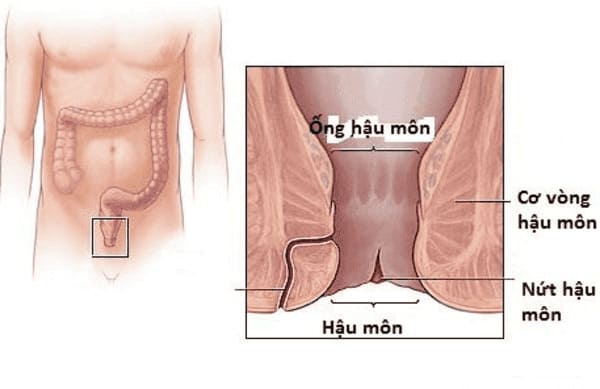 Nguyên nhân gây nứt kẽ hậu môn