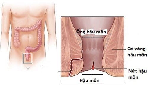 Kiến thức cơ bản cần biết về nứt kẽ hậu môn