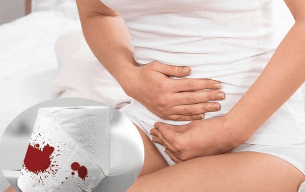 Khi nào nên bắt đầu điều trị nứt kẽ hậu môn?