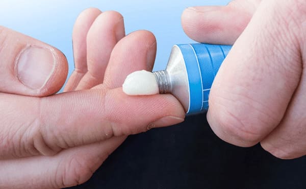 Phác đồ điều trị nứt kẽ hậu môn: Sử dụng thuốc bôi