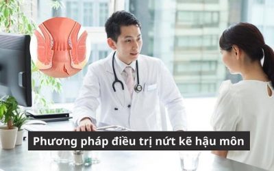 Phương pháp điều trị nứt kẽ hậu môn: Cách nào hiệu quả, ít tái phát?