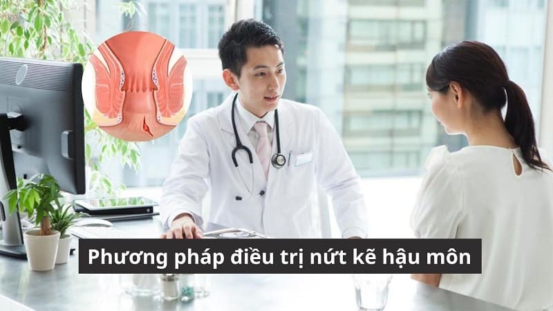 Phương pháp điều trị nứt kẽ hậu môn: Cách nào hiệu quả, ít tái phát?