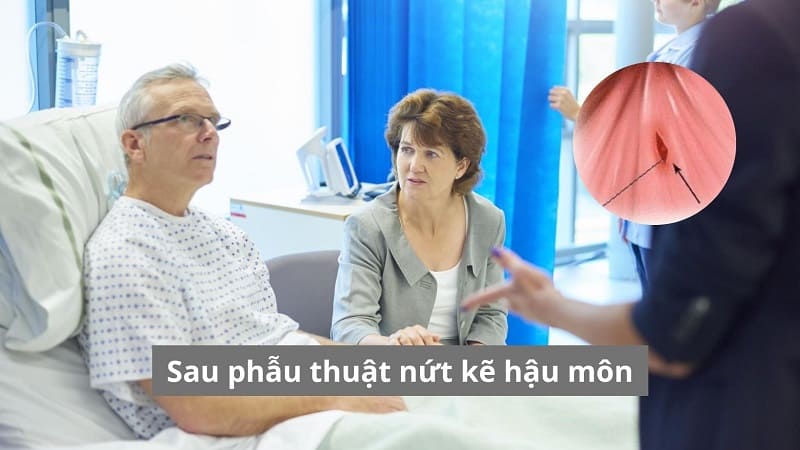Sau phẫu thuật nứt kẽ hậu môn: Thời gian hồi phục và những lưu ý quan trọng để không tái phát