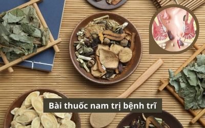 Bài thuốc nam trị bệnh trĩ và những điều quan trọng không nên bỏ qua