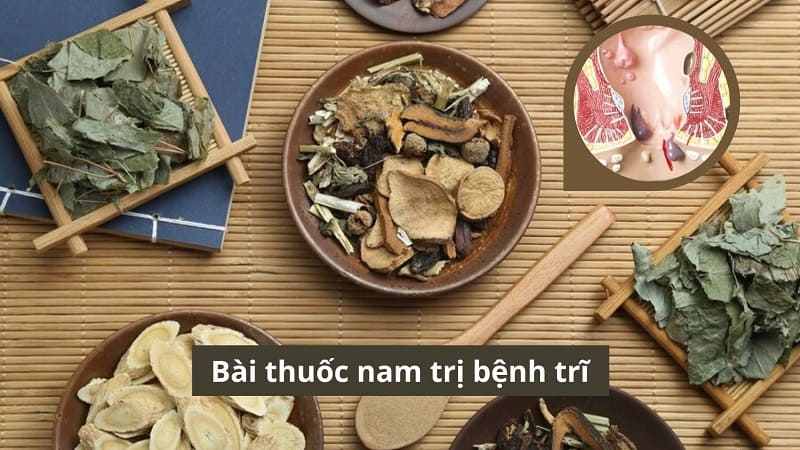 Bài thuốc nam trị bệnh trĩ và những điều quan trọng không nên bỏ qua
