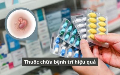 Top 10 loại thuốc chữa bệnh trĩ hiệu quả nhất trên thị trường hiện nay
