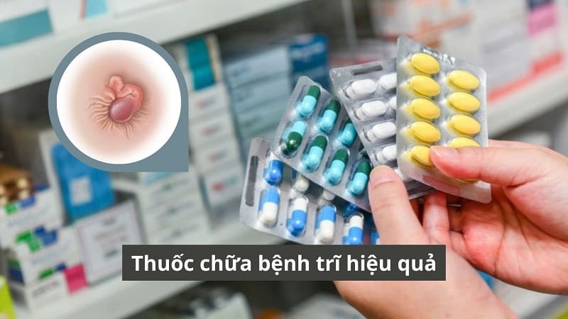 Top 10 loại thuốc chữa bệnh trĩ hiệu quả nhất trên thị trường hiện nay